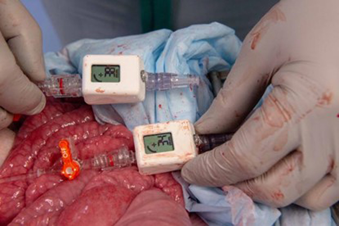 Figure 1: COMPASS® Centurion (Mirador Biomedical, Seattle, WA) device being tested during REBOA therapy in a large animal model of massive bleeding
