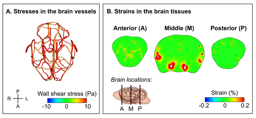Figure 1. (A) Compared to a blast-free condition, the substantial increases in the peak shear stress in the cerebral vasculature of a rat caused by a torso-only exposure indicate that the indirect mechanism may cause vascular injury. (B) The predicted minimal increases in the peak strain in the brain tissues of a torso-only-exposed rat indicate that the indirect mechanism is very unlikely to cause strain-induced damage to the tissues.